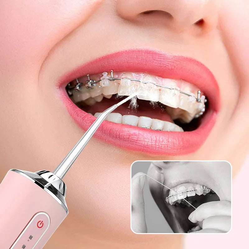 Irrigador Oral Portátil Dental - Dentes Mais Limpos [NOVO]