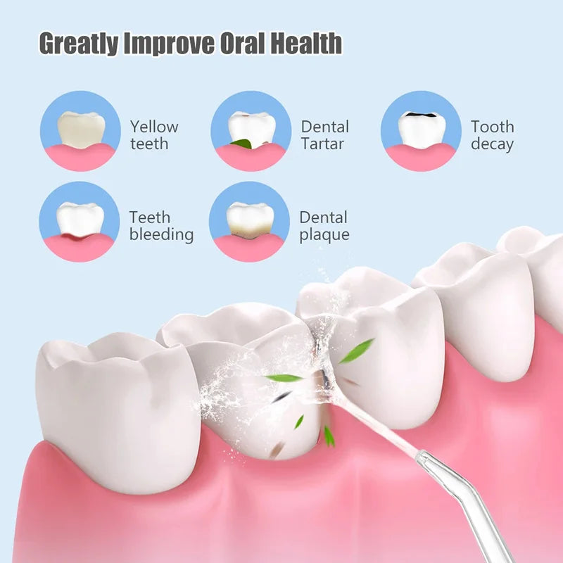 Irrigador Oral Portátil Dental - Dentes Mais Limpos [NOVO]